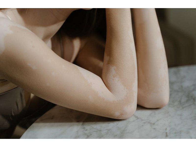 131 refusal to accept appointed officials